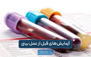 آزمایش‌های قبل از عمل بینی و رینوپلاستی + نحوه خواندن جواب آزمایش