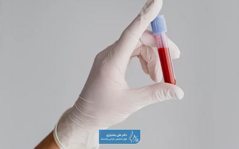 آزمایش PT و PTT از انواع آزمایش قبل از عمل جراحی بینی