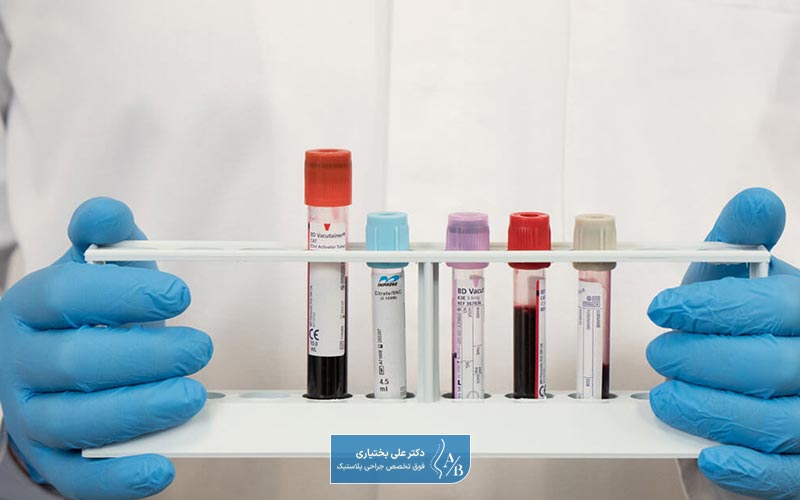 نحوه خواندن جواب آزمایش عمل بینی بعد از گرفتن آن