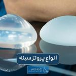 انواع پروتز سینه و معرفی بهترین مدل آن برای زنان