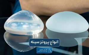 انواع پروتز سینه و معرفی بهترین مدل آن برای زنان