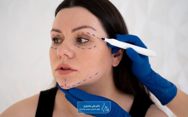 مراقبت های بعد از مینی لیفت صورت چه مواردی است؟