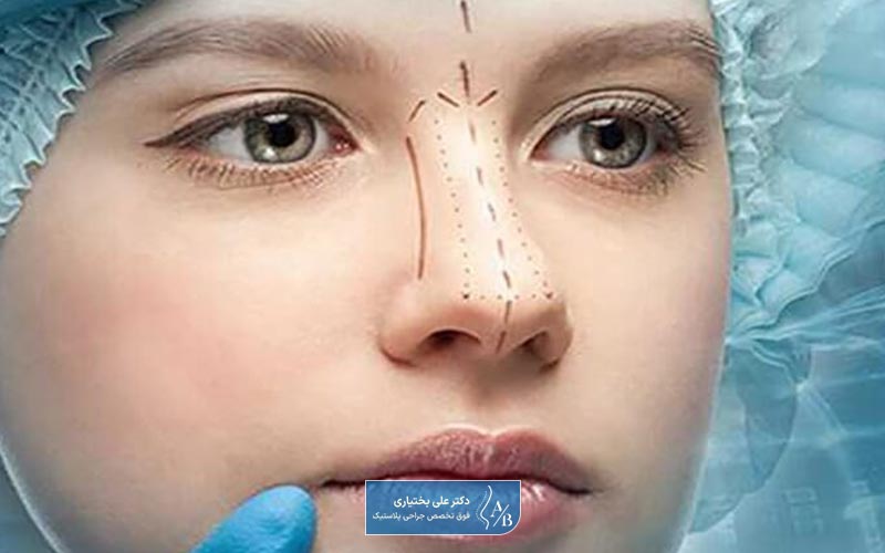 حداقل و حداکثر قیمت و هزینه رینوپلاستی در ایران چقدر است؟ کجا ارزان تر است؟