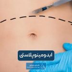 ابدومینوپلاستی چیست؟ عوارض و مزایا جراحی زیبایی شکم