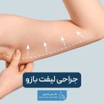 جراحی لیفت بازو یا براکیوپلاستی چیست و چه مزایا و عوارضی دارد