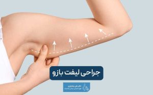 جراحی لیفت بازو یا براکیوپلاستی چیست و چه مزایا و عوارضی دارد