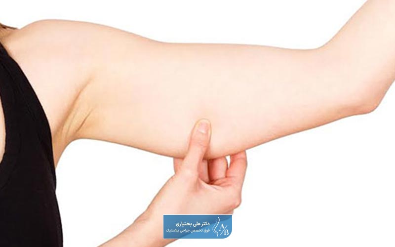 عوارض براکیوپلاستی