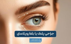 جراحی پلک یا بلفاروپلاستی چیست؟ انواع مزایا و عوارض عمل زیبایی پلک
