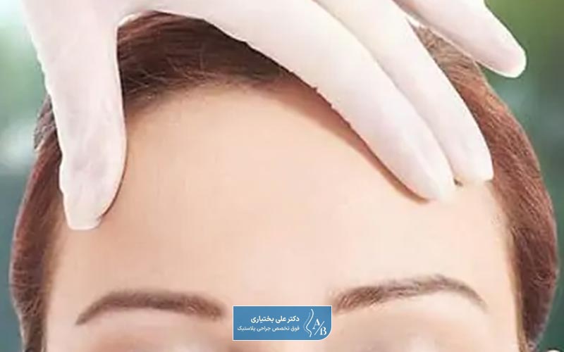 لیفت پیشانی چیست و چه کاربردی دارد