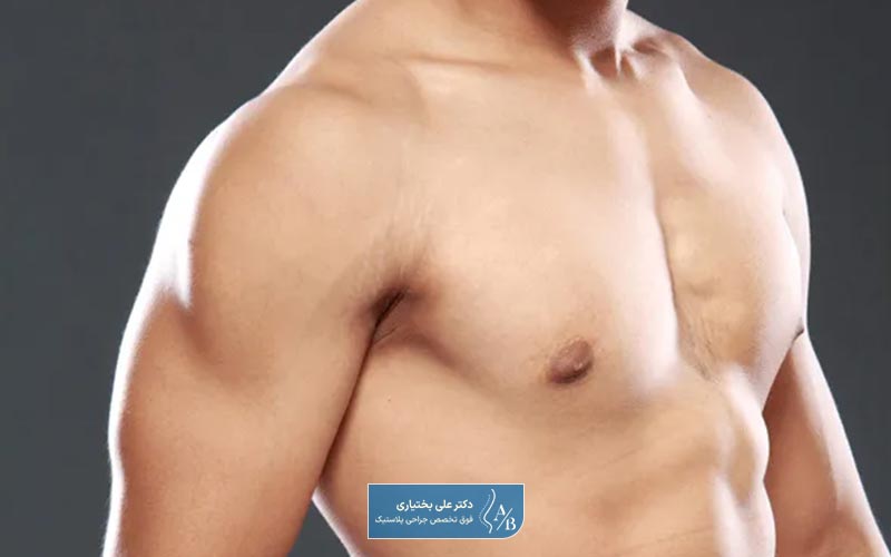 عمل جراحی کوچک کردن سینه یکی از روش‌های درمان ژنیکوماستی مردانه است