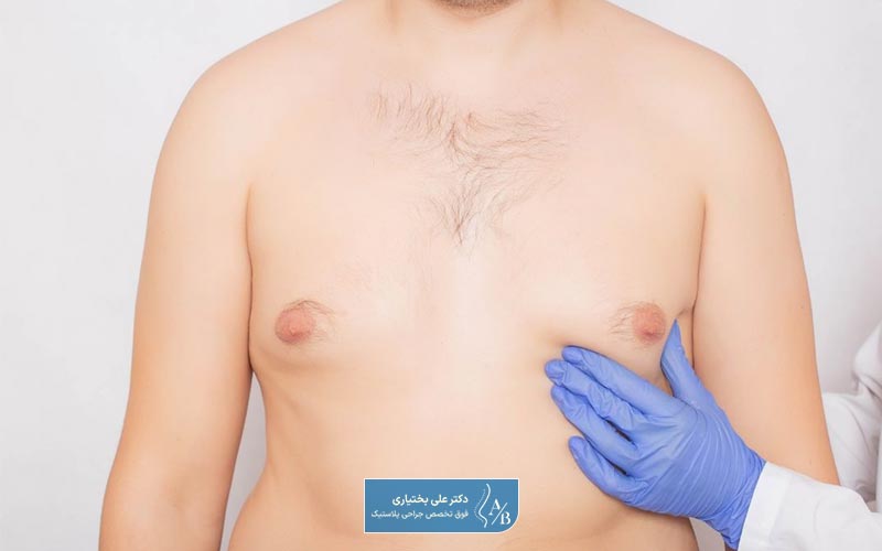 ژنیکوماستی چیست و مراحل عمل جراحی کوچک کردن سینه در مردان