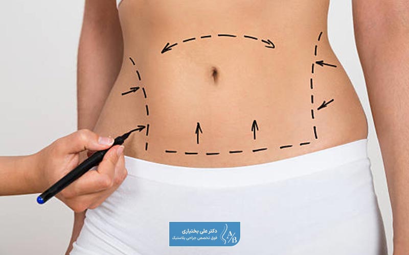 یکی از روش ها و تکنیک های جراحی لیپوپلاستی، جراحی با استفاده از اولتراسونیک است