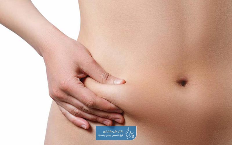 انواع روش لیپوپلاستی برای لاغری به سبک نوین