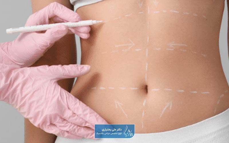 لیپوپلاستی چیست و چه هدفی از انجام آن داریم؟