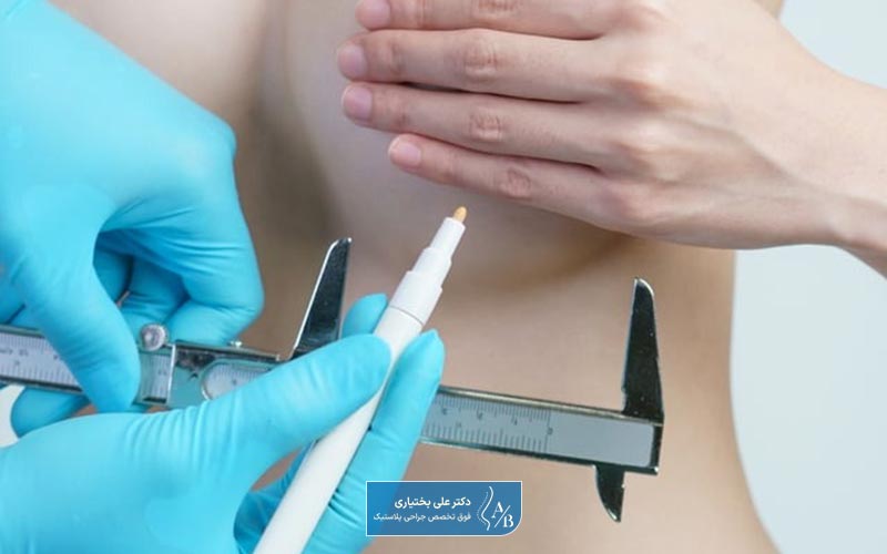 عمل ماموپلاستی چیست و چه کاربردی دارد