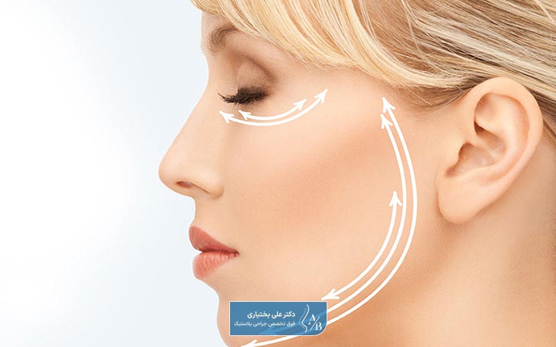 عوامل موثر بر هزینه مینی لیفت صورت در سال 1404 (مینی فیس لیفت) در تهران