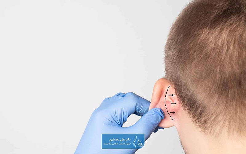 انواع روش‌ها و تکنیک‌های عمل گوش در ایران