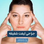 جراحی لیفت شقیقه چیست و انواع روش و تکنیک عمل آن
