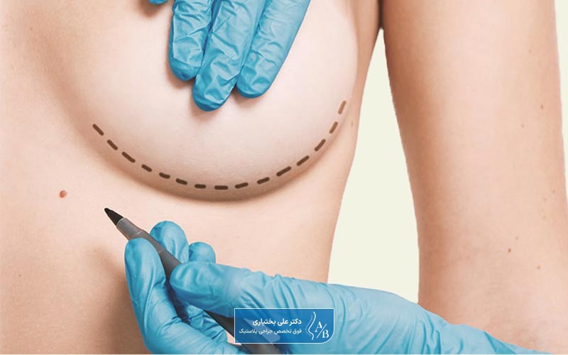 عمل کوچک کردن سینه در زنان یکی از جراحی های زیبایی است که محبوب است