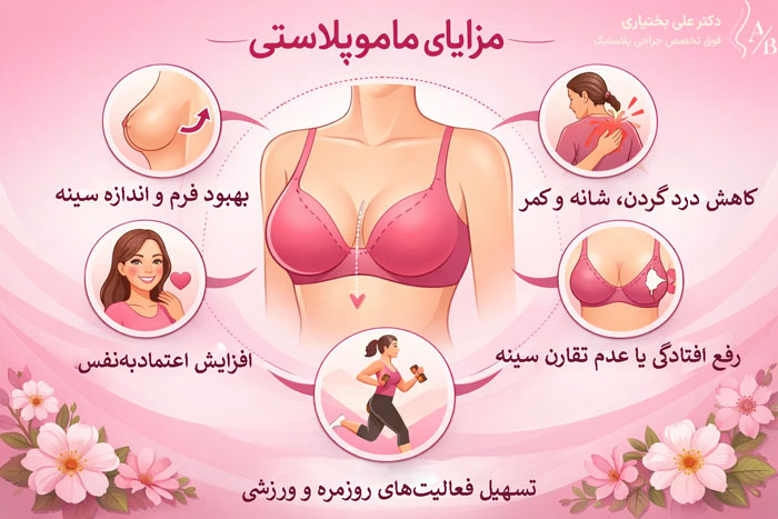 مزایا ماموپلاستی