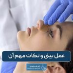 عمل بینی چیست؟ 7 روش عمل و نکات مهم قبل از جراحی زیبایی بینی
