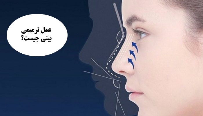 عمل ترمیمی بینی چیست